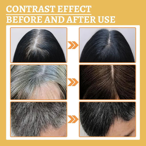 proskire anti grey hair serum